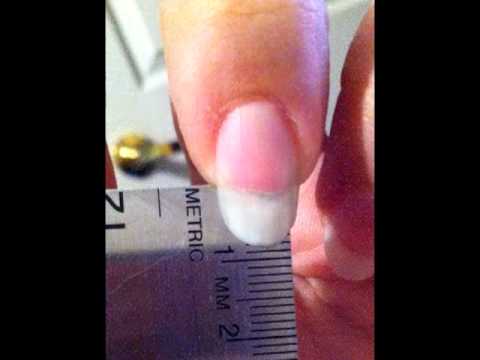 The Life and Death of a Fingernail