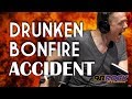 Christopher Titus Fell Into a Bonfire At 17