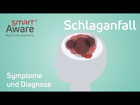 Stroke: Symptoms and Diagnosis | Professional Development for Nursing | Continuing Education for ...