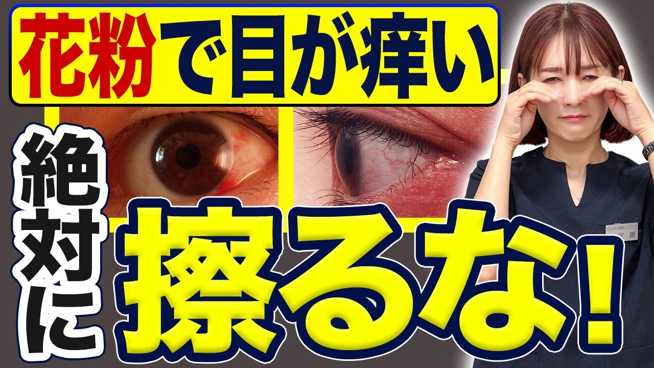 花粉症の人、絶対にやってはいけない目のこすり方
