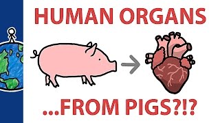 Should We Grow Human Organs In Pigs?