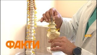 Изобретение, которое спасает жизни. Украинец создал уникальный имплант для позвоночника