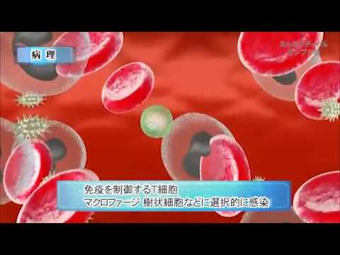 後天性免疫不全症候群について詳しく解説