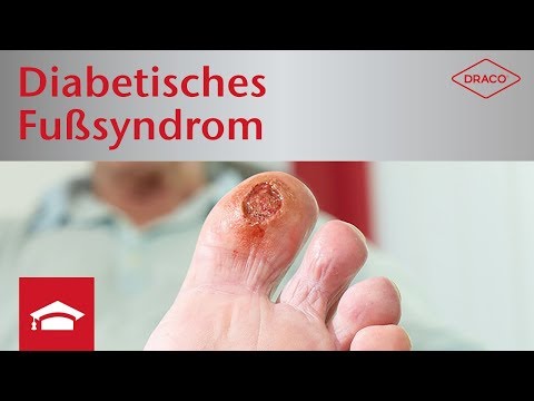 Was ist die Analyse eines versteckten Diabetes in der Schwangerschaft Als Sie brauchen, um einen niedrigeren Blutzucker zu essen