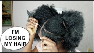 I'M LOSING MY HAIR | Hair Loss -My Postpartum