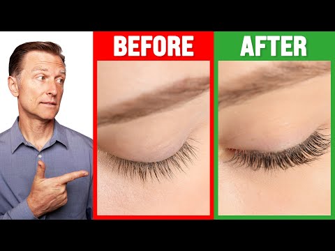 YouTube video about: Why are my eyelashes so short?