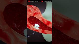 Early-stage ABORTION Procedure 3D Animation🔥🔥