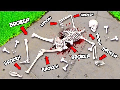 Breaking EVERY BONE As SKELETON In GTA 5!