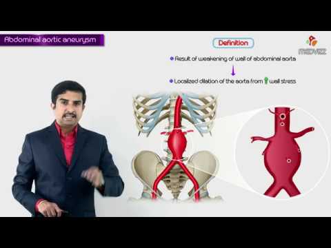 Best Abdominal Aortic Aneurysm (AAA) Hospitals in India