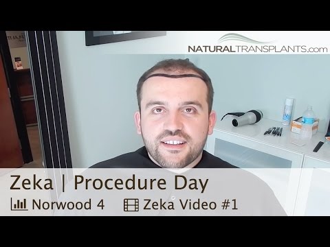 download lagu mp3 mp4 Hair Replacement Jacksonville, download lagu Hair Replacement Jacksonville gratis, unduh video klip Hair Replacement Jacksonville