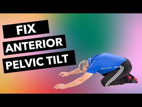 Fix Anterior Pelvic Tilt (4 Critical Exercises)