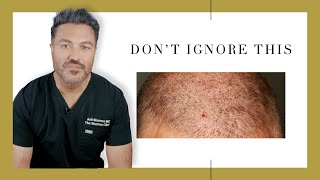Canadian Hair Transplant Centre