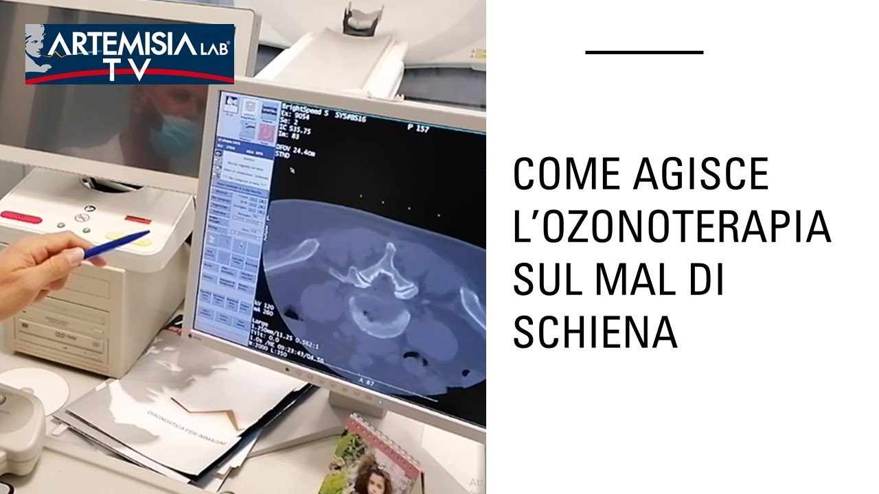 COME AGISCE L'OZONOTERAPIA SUL MAL DI SCHIENA