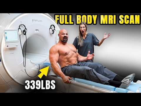 FULL BODY MRI BODY FAT % SCAN | GREG IS GOING TO BE ...