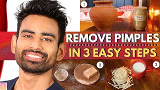ULTIMATE Ayurvedic Routine to Get Rid of Pimples & Acne Permanently (Men & Women)