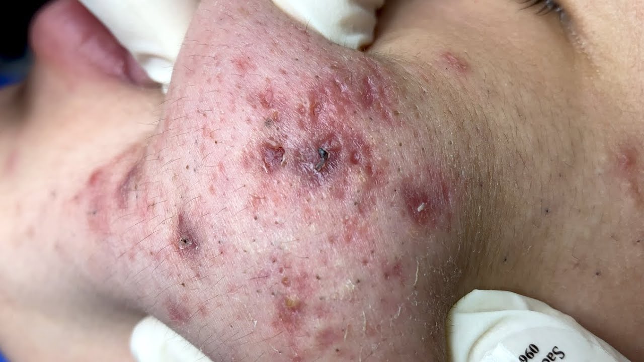 YouTube Thumbnail Downloader FULL HQ IMAGE