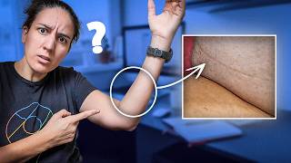 Personne ne parle de cette ligne sur l’avant-bras (et c’est bizarre)