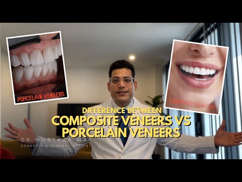 Composite VS Porcelain Veneers - Which is better? Watch this before you make your Decision