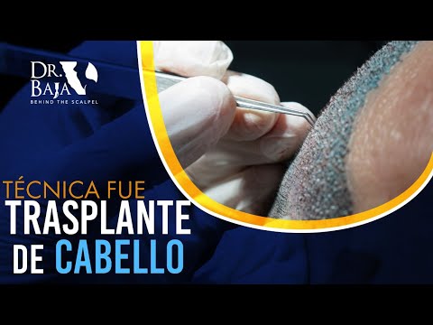 Renato Rodríguez Hirales-58