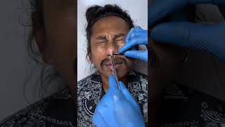 Download lagu Nangis saat di tindik - oneng art tattoo studio mp3