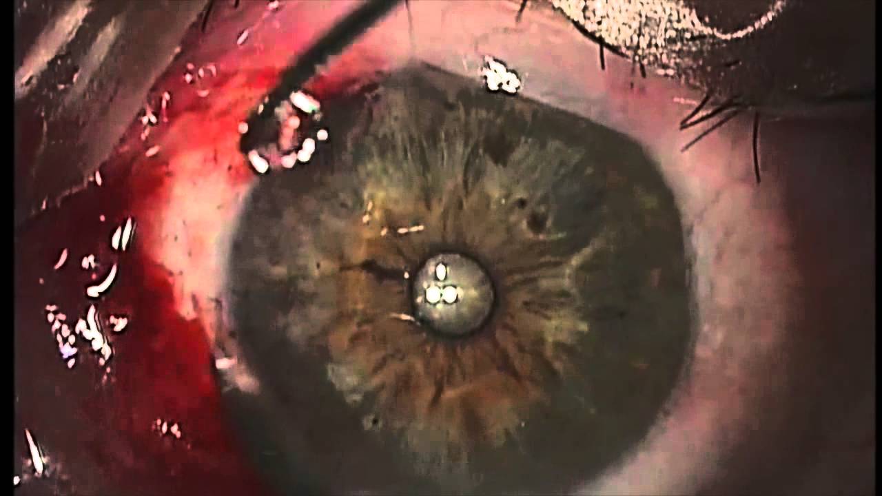 Alessandro Sammartino-5