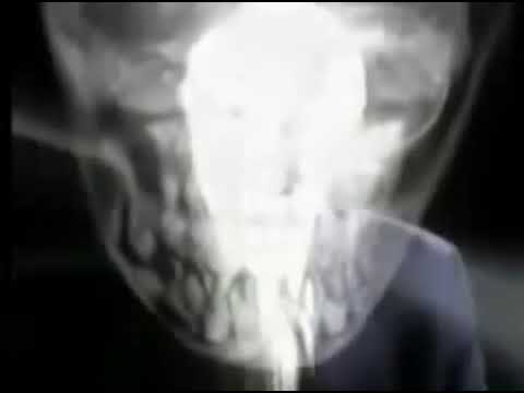 Associação parceria contra as drogas Boris Casoy -Partnership against drugs association  Boris Casoy