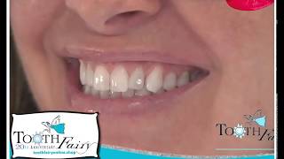 Tooth Fairy Swarovski® Tooth Crystals Home Kit
