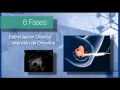 IVI - Fecundación in vitro (FIV) paso a paso y transferencia de embriones (UE, 2014) IVI - Fecundación in vitro (FIV) paso a paso y transferencia de embriones (UE, 2014)