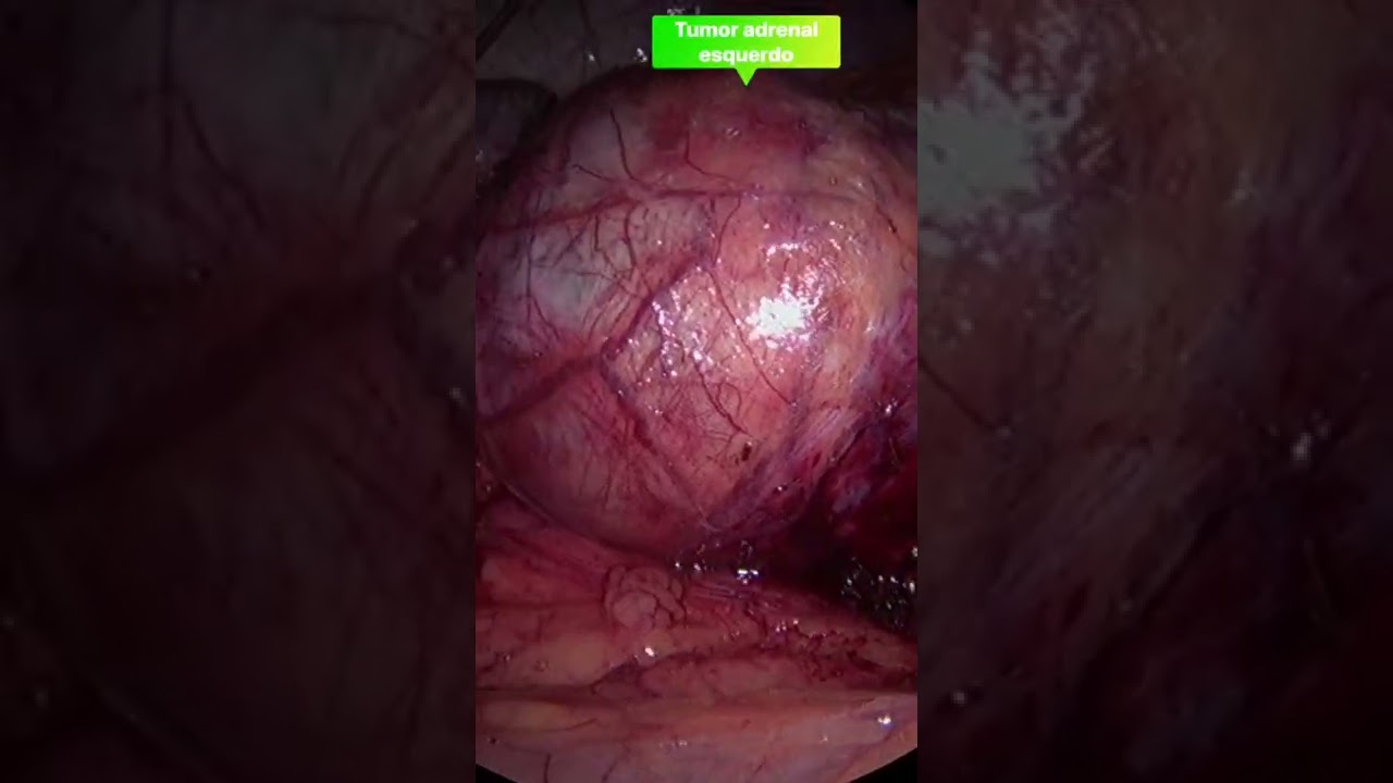 Fabio Sant Anna De Moraes-30