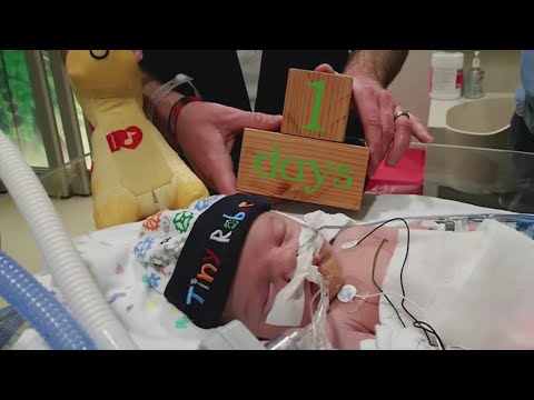 Rochester family raising awareness after child born with rare birth defect