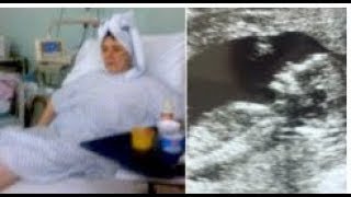 Pregnant Teen Suffers Early Stages Of Miscarriage 9 Times Before Giving Birth To That Same Baby