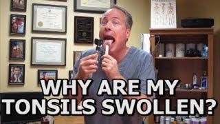 Natural Solutions For Swollen Tonsils. How To Avoid A Tonsillectomy  (Common Sense Medicine)