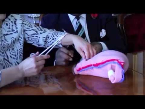 Transverse Compression Suture to control bleeding fro PPH Placenta Previa by  Prof B-Lynch