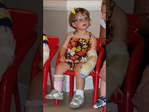 Abordaje de pacientes con daño cerebral adquirido con carro Snoezelen