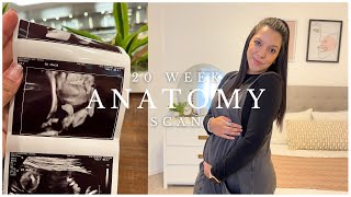 OUR 20 WEEK ANATOMY SCAN VLOG + Baby Update!