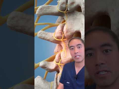 RFA Doctor Explained