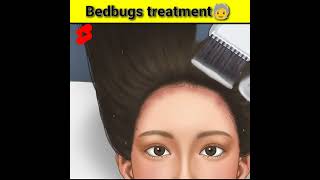 Treatment of bed bugs in hair🧓through animation 🤯#shorts #mrindianhacker #crazyxyz