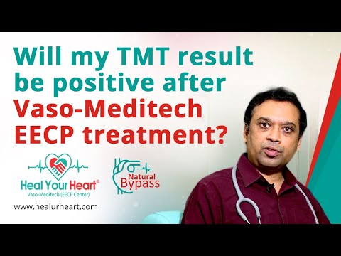 Will my TMT result be positive after Vaso-Meditech EECP treatment?