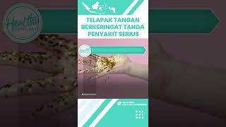 Jangan Disepelekan! Telapak Tangan Sering Berkeringat Bisa Jadi Tanda Penyakit Serius