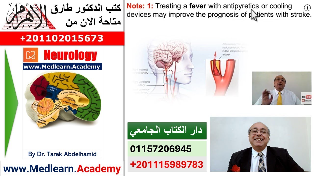 Neurology Stroke (I) - C