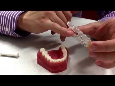 download lagu mp3 mp4 Dental Wax For Invisalign, download lagu Dental Wax For Invisalign gratis, unduh video klip Dental Wax For Invisalign