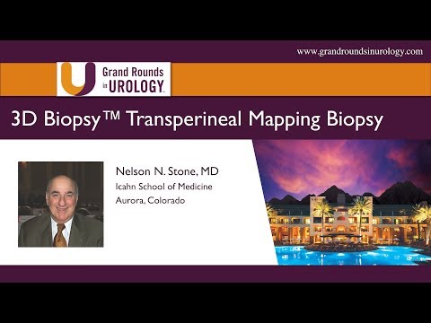 3D Biopsy:  Transperineal Mapping Biopsy
