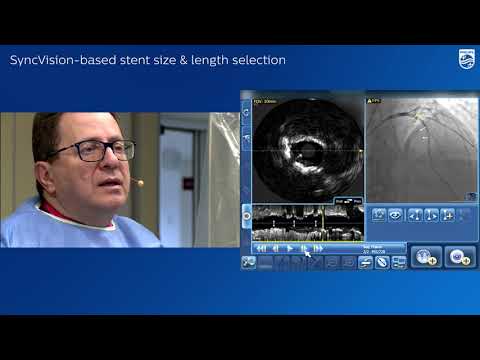 Bifurcation stenting