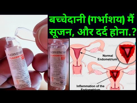 Placentrex Injection 2ml