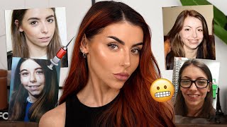 EVERYTHING I’ve had done to my face | The TRUTH - Botox, Fillers, Surgery..