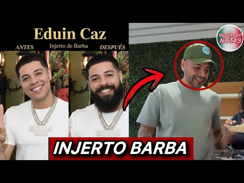 Eduin Caz got a beard transplant 😨
