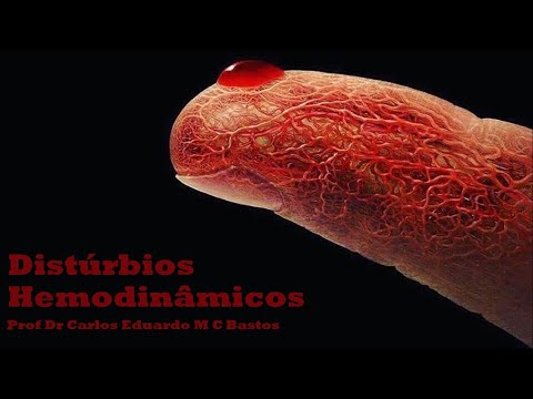 PATOLOGIA GERAL -  Distúrbios Hemodinâmicos