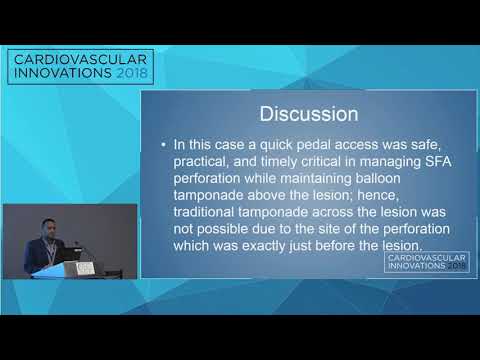 CVI2018 Session: Retrograde Tibiopedal Access as a Bail-Out Procedure - Ahmed Amro, MD