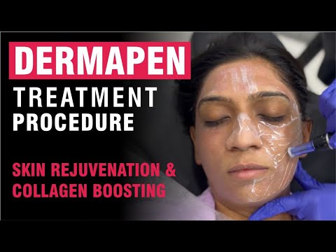 Dermapen Treatment Procedure - Skin Rejuvenation &...