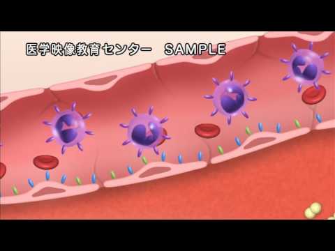 アトラントケリスについて詳しく解説